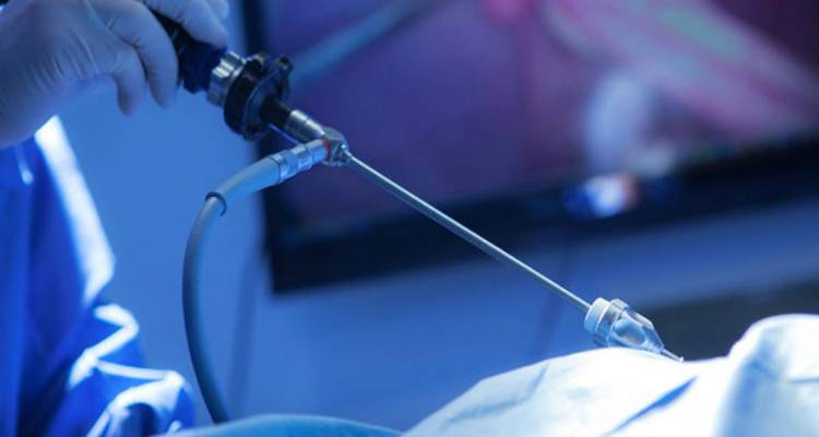 Άριστο το ογκολογικό αποτέλεσμα της λαπαροσκοπικής κολεκτομής για τον καρκίνο του παχέος εντέρου