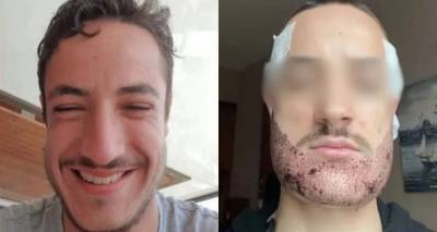 &Alpha;&upsilon;&tau;&omicron;&kappa;&tau;ό&nu;&eta;&sigma;&epsilon; &Gamma;ά&lambda;&lambda;&omicron;&sigmaf; &phi;&omicron;&iota;&tau;&eta;&tau;ή&sigmaf; &mu;&epsilon;&tau;ά &alpha;&pi;ό &mu;&epsilon;&tau;&alpha;&mu;ό&sigma;&chi;&epsilon;&upsilon;&sigma;&eta; &gamma;&epsilon;&nu;&epsilon;&iota;ά&delta;&alpha;&sigmaf; &sigma;&tau;&eta;&nu; &Tau;&omicron;&upsilon;&rho;&kappa;ί&alpha;