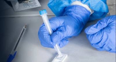 &Kappa;&omicron;&rho;&omega;&nu;&omicron;ϊό&sigmaf; - &Gamma;&kappa;ά&gamma;&kappa;&alpha;: &Delta;&epsilon;&nu; &chi;&rho;&epsilon;&iota;ά&zeta;&epsilon;&tau;&alpha;&iota; PCR &tau;&epsilon;&sigma;&tau; έ&pi;&epsilon;&iota;&tau;&alpha; &alpha;&pi;ό &theta;&epsilon;&tau;&iota;&kappa;ό Rapid