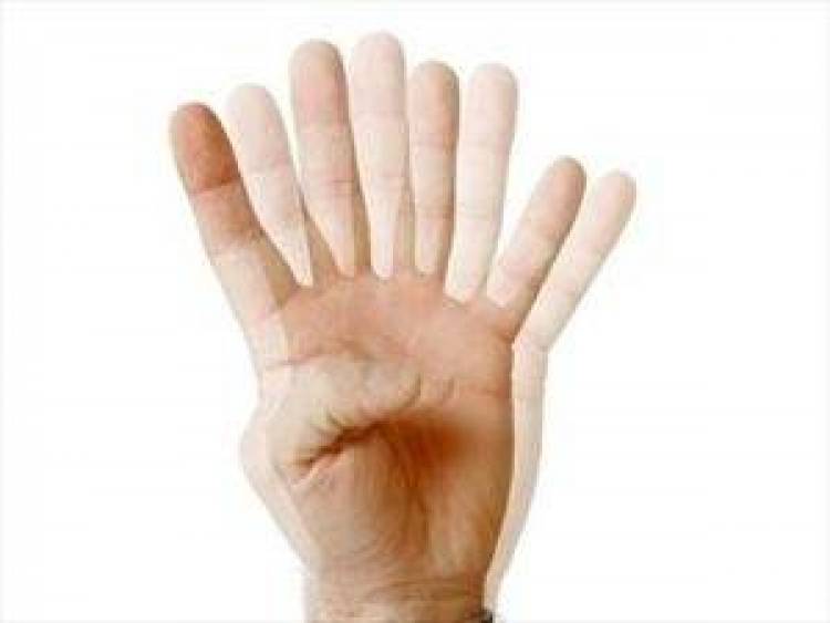 &Delta;&iota;&pi;&lambda;&omega;&pi;ί&alpha;. &Tau;&iota; &mu;&pi;&omicron;&rho;&epsilon;ί &nu;&alpha; &kappa;&rho;ύ&beta;&epsilon;&iota;;