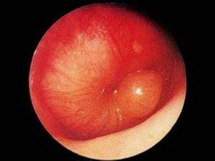 &Pi;&omega;&sigmaf; &alpha;&nu;&tau;&iota;&mu;&epsilon;&tau;&omega;&pi;ί&zeta;&omicron;&upsilon;&mu;&epsilon; &tau;&eta;&nu; &Omicron;&xi;&epsilon;ί&alpha; &Mu;έ&sigma;&eta; &Omega;&tau;ί&tau;&iota;&delta;&alpha;