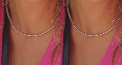 &Lambda;ή&mu;&nu;&omicron;&sigmaf;: Έ&kappa;&kappa;&lambda;&eta;&sigma;&eta; &gamma;&iota;&alpha; &epsilon;&nu;&tau;&omicron;&pi;&iota;&sigma;&mu;ό &alpha;&lambda;&upsilon;&sigma;ί&delta;&alpha;&sigmaf; &lambda;&alpha;&iota;&mu;&omicron;ύ &pi;&omicron;&upsilon; &chi;ά&theta;&eta;&kappa;&epsilon; &sigma;&tau;&eta; &Mu;ύ&rho;&iota;&nu;&alpha;