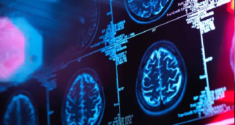 Αλτσχάιμερ: Νέο πειραματικό  φάρμακο για την καταπολέμηση της νόσου