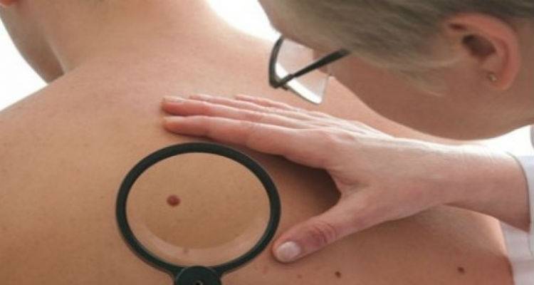 &Delta;&omega;&rho;&epsilon;ά&nu; &epsilon;&xi;έ&tau;&alpha;&sigma;&eta; &mu;&epsilon;&lambda;&alpha;&nu;ώ&mu;&alpha;&tau;&omicron;&sigmaf; &sigma;&tau;&eta; &Lambda;ή&mu;&nu;&omicron;