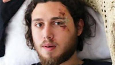 Φοιτητής εισέπραξε γροθιές επειδή δεν πλήρωσε χωρίς απόδειξη