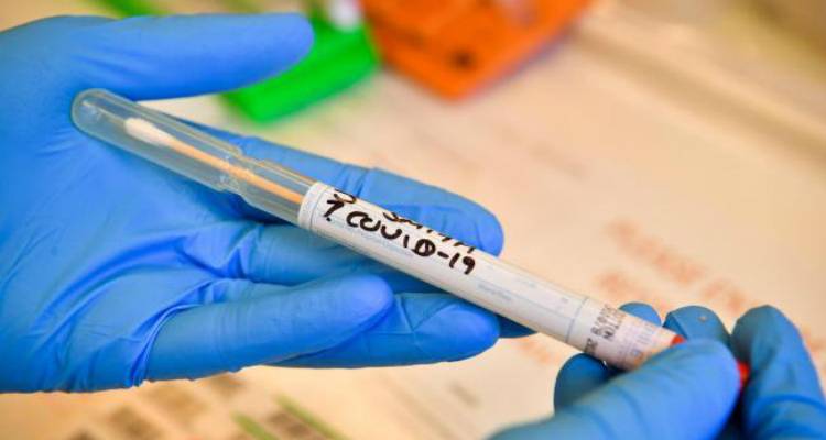 Κορωνοϊός: Μετ&#039; εμποδίων τα διαγνωστικά τεστ στη Βρετανία