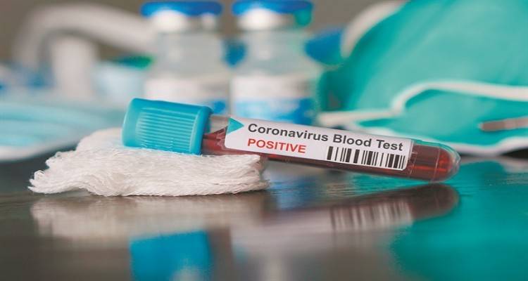 ΛΑΣ Λήμνου: «Μέτρα πρόληψης και αντιμετώπισης της πιθανής διασποράς του κορωνοϊου στη Λήμνο