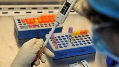Ανακαλύφθηκε γονίδιο που μπορεί να σταματήσει την εξάπλωση του ιού του AIDS
