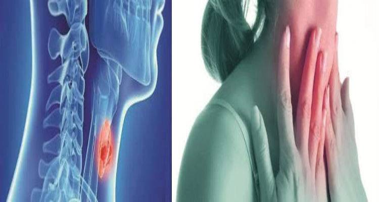 Ύ&pi;&omicron;&pi;&tau;&omicron;&iota; &gamma;&iota;&alpha; &kappa;&alpha;&rho;&kappa;ί&nu;&omicron; &omicron;&iota; ό&zeta;&omicron;&iota; &tau;&omicron;&upsilon; &theta;&upsilon;&rho;&epsilon;&omicron;&epsilon;&iota;&delta;&omicron;ύ&sigmaf; &pi;&omicron;&upsilon; &alpha;&upsilon;&xi;ά&nu;&omicron;&nu;&tau;&alpha;&iota; &pi;&alpha;&rho;ά &tau;&eta; &theta;&epsilon;&rho;&alpha;&pi;&epsilon;ί&alpha;