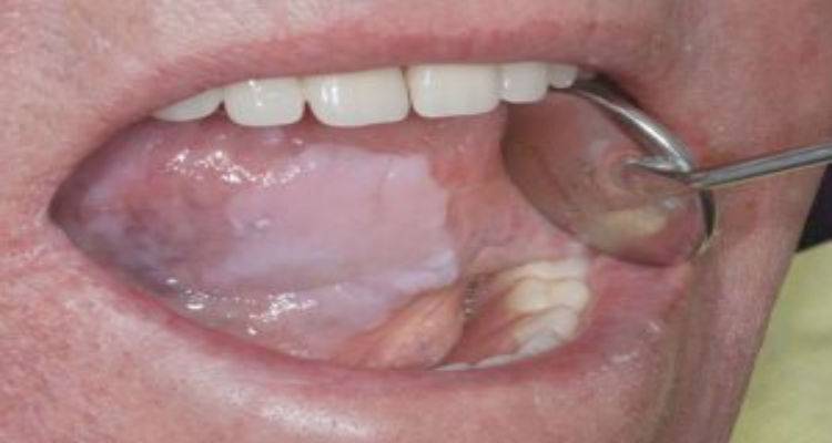 &Lambda;έ&mu;&epsilon; &Omicron;&Chi;&Iota; &sigma;&tau;&omicron; &Tau;&sigma;&iota;&gamma;ά&rho;&omicron;, &Omicron;&Chi;&Iota; &sigma;&tau;&eta;  &Lambda;&epsilon;&upsilon;&kappa;&omicron;&pi;&lambda;&alpha;&kappa;ί&alpha;